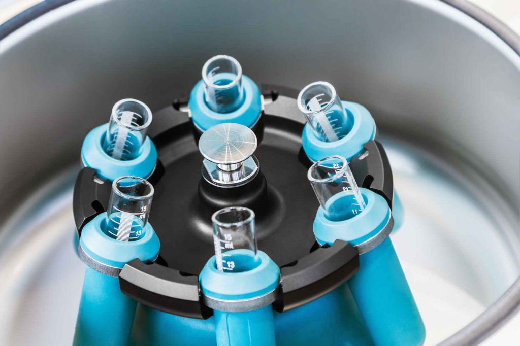 Medical,Device,Centrifuge,For,Mixing,In,The,Laboratory.,Modern,Technologies Medical,Device,Centrifuge,For,Mixing,In,The,Laboratory.,Modern,Technologies