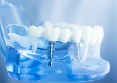 Dental,Tooth,Dentistry,Student,Learning,Teaching,Model,Showing,Teeth,,Roots,